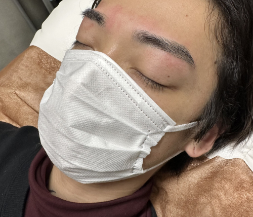 アイブロウWAX脱毛